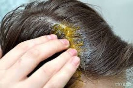 قطره درمان ریزش مو زاندروکس - 1