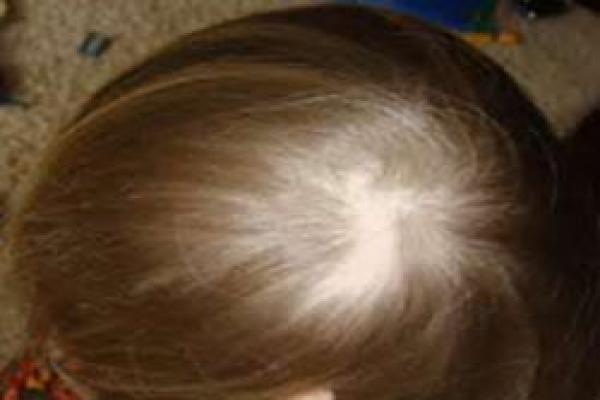 تقویت موی نوزادان با 5 ماده شگفت انگیز
